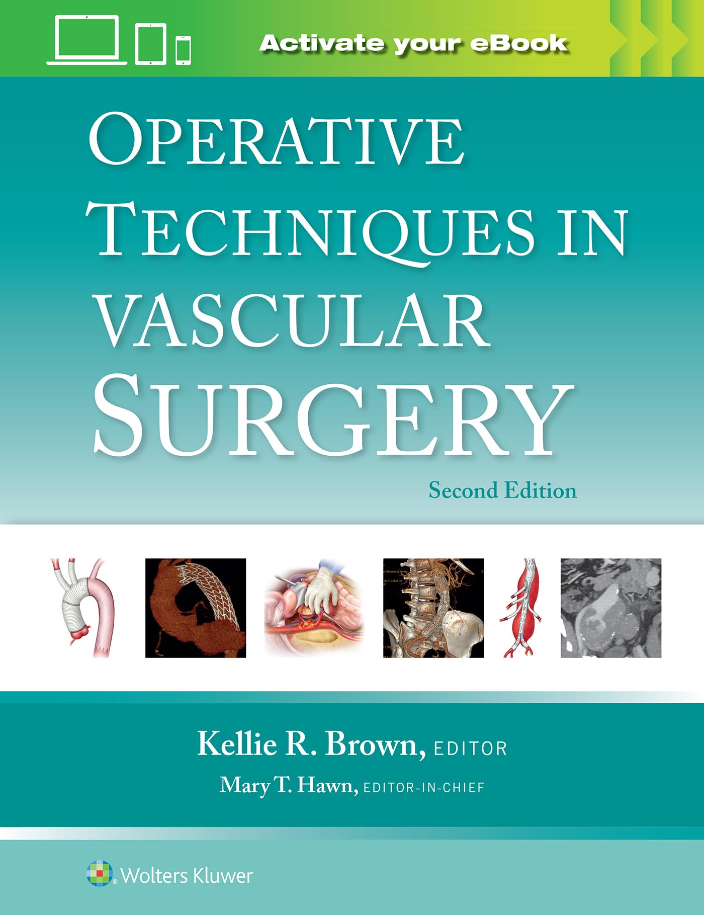 Operative Techniques in Vascular Surgery: Print  eBook with Multimedia
