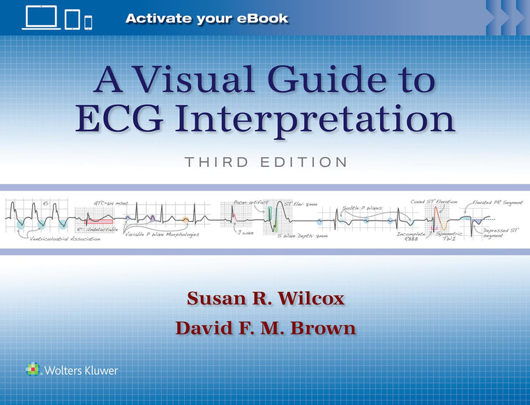 A Visual Guide to ECG Interpretation: Print  eBook with Multimedia