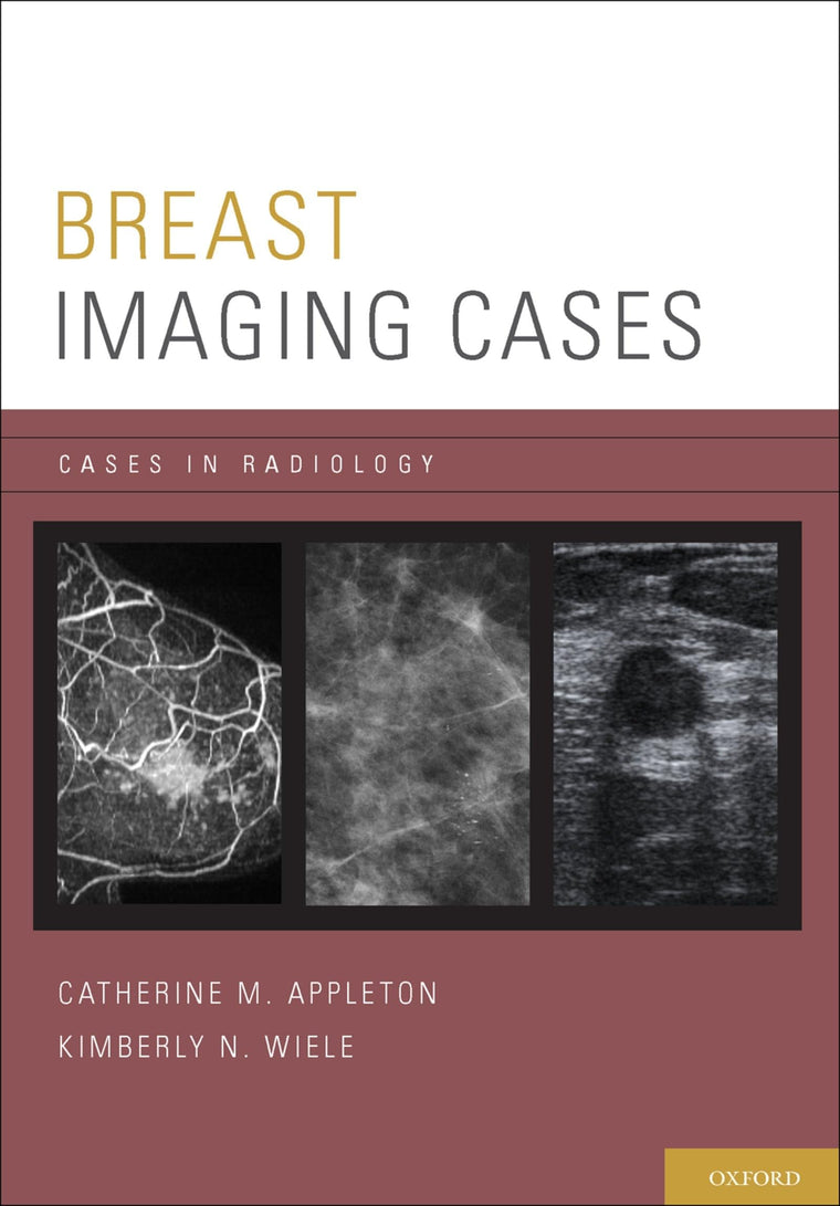 Breast Imaging Cases (Cases in Radiology)