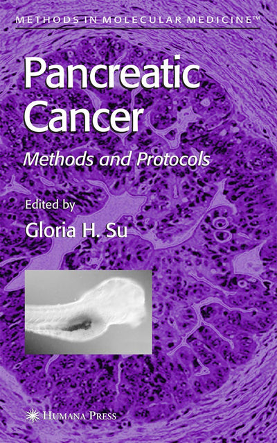 Pancreatic Cancer: Methods and Protocols (Methods in Molecular Medicine, 103)