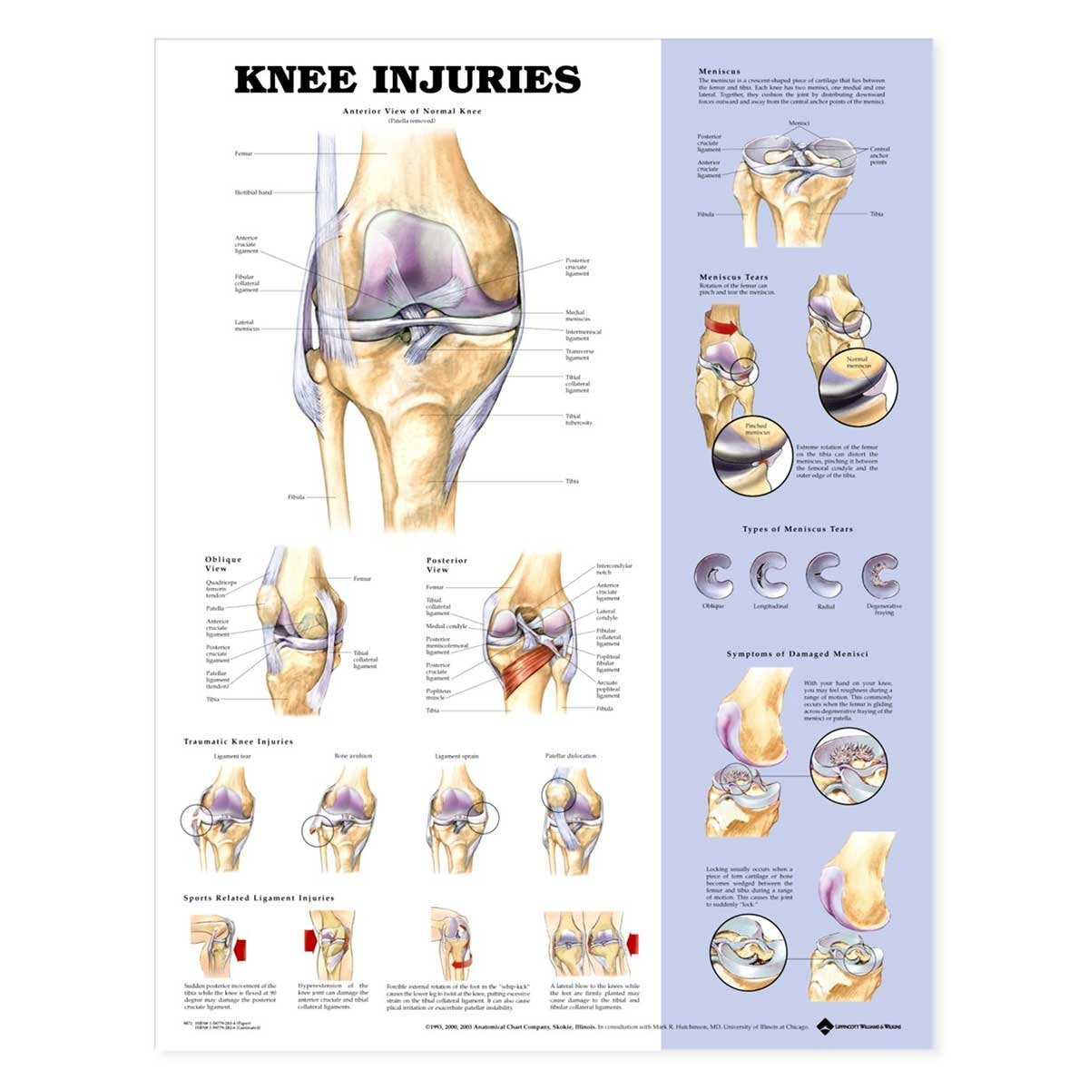 Knee Injuries Anatomical Chart