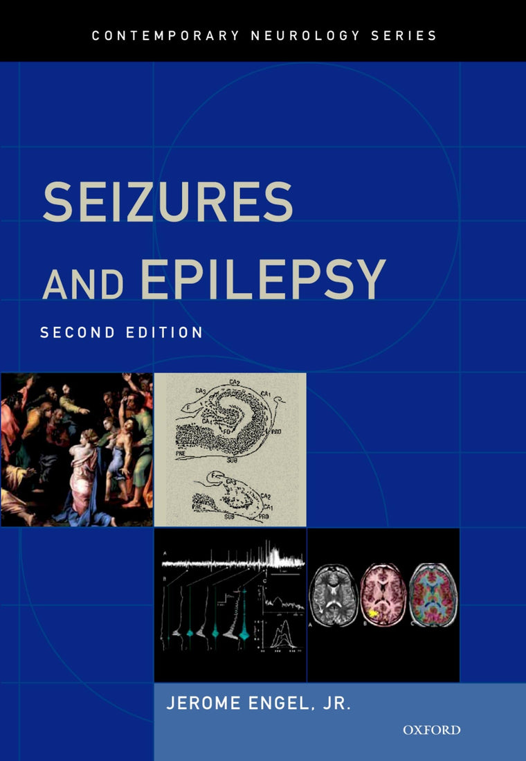 Seizures and Epilepsy (Contemporary Neurology Series)