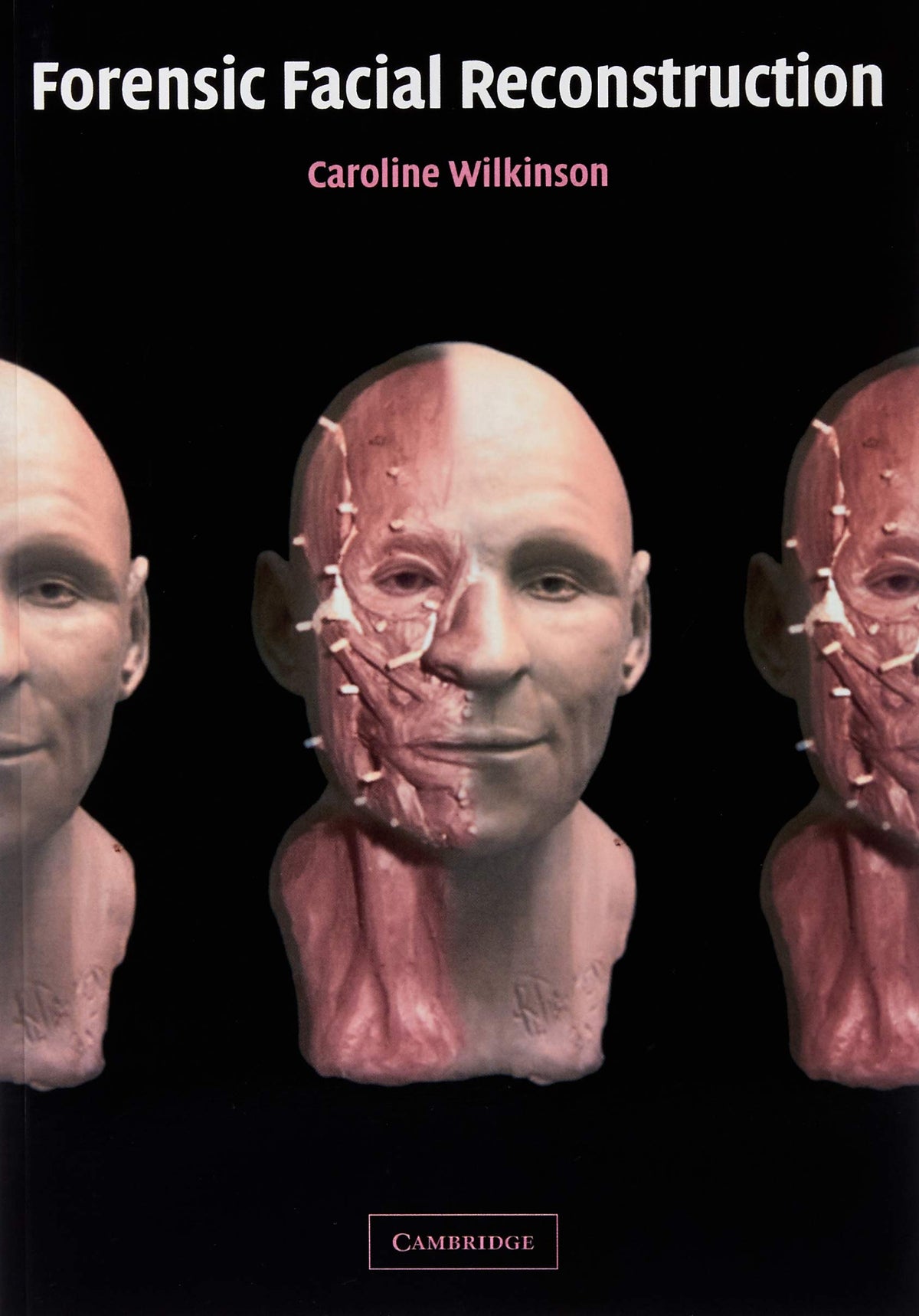 Forensic Facial Reconstruction