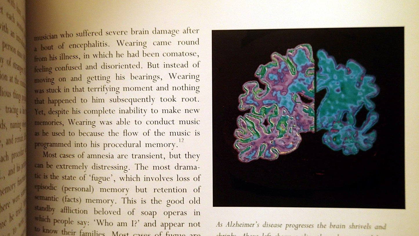 Mapping the Mind