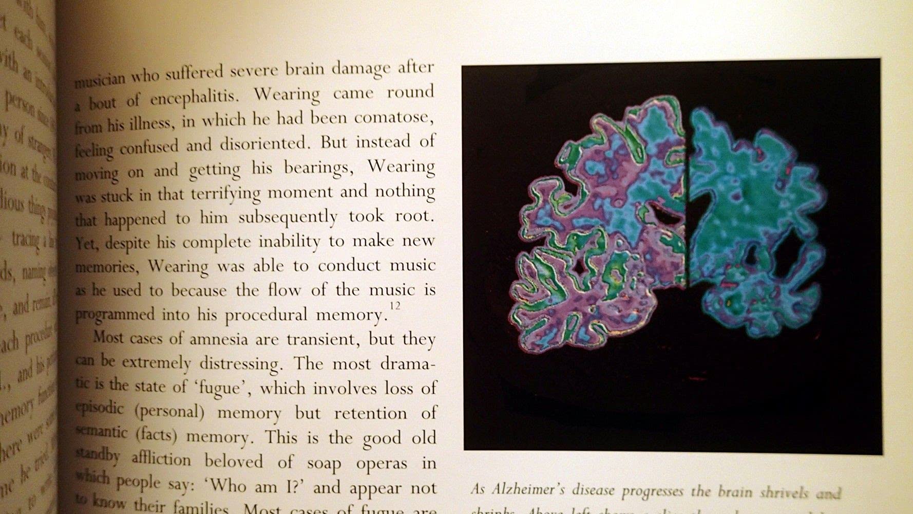 Mapping the Mind