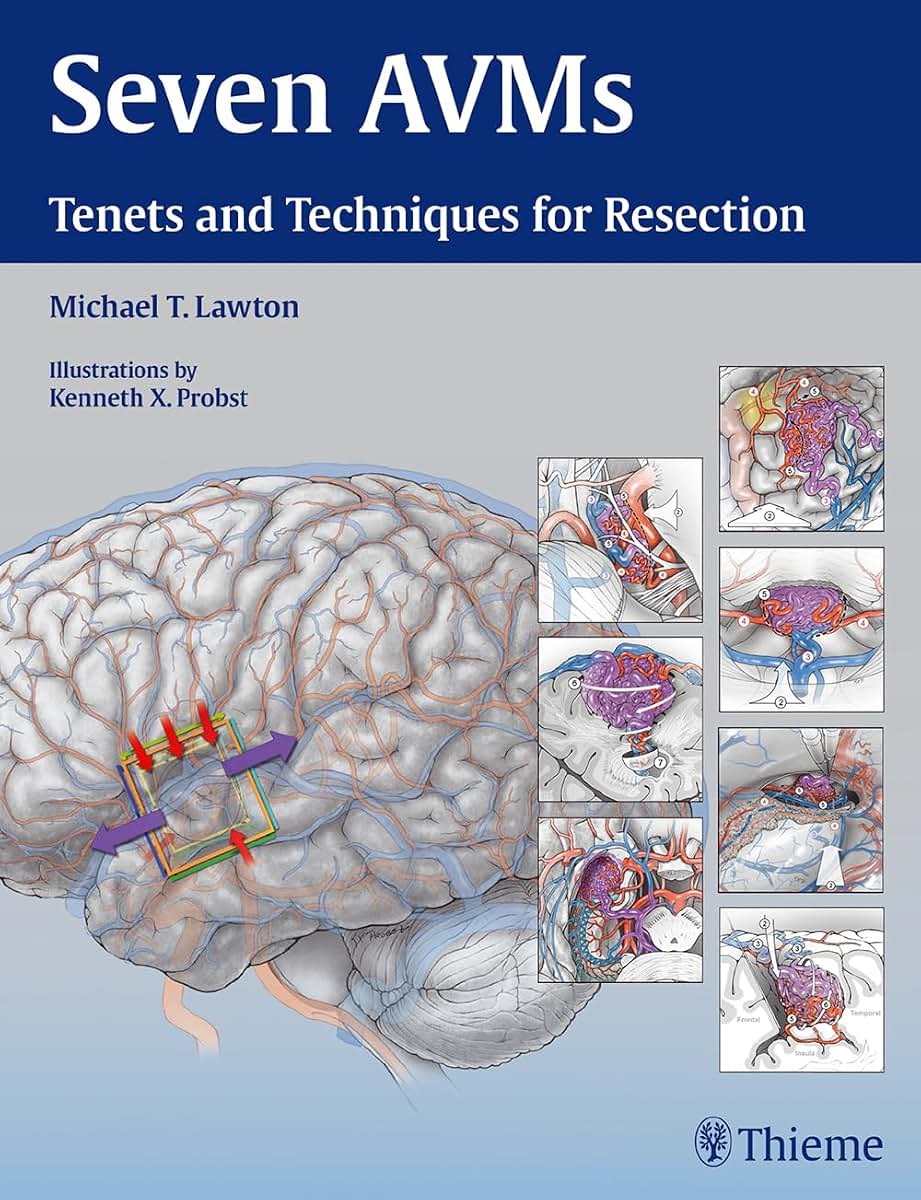 Seven AVMs: Tenets and Techniques for Resection