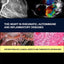 The Heart in Rheumatic, Autoimmune and Inflammatory Diseases: Pathophysiology, Clinical Aspects and Therapeutic Approaches