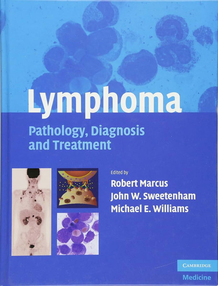 Lymphoma: Pathology, Diagnosis and Treatment