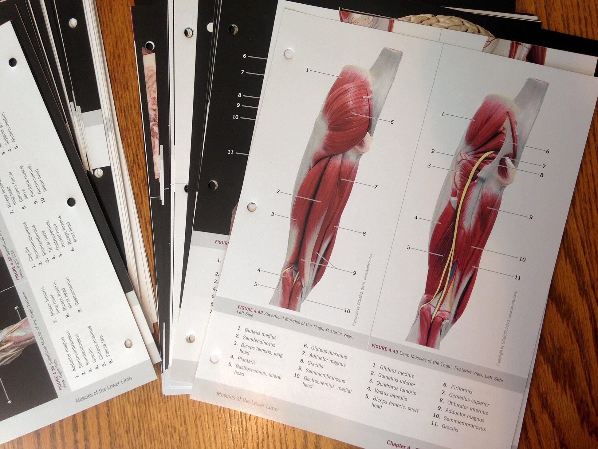 Photographic Atlas for Anatomy & Physiology, A
