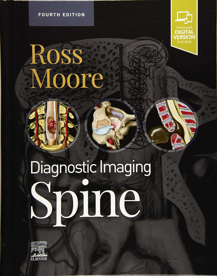 Diagnostic Imaging: Spine