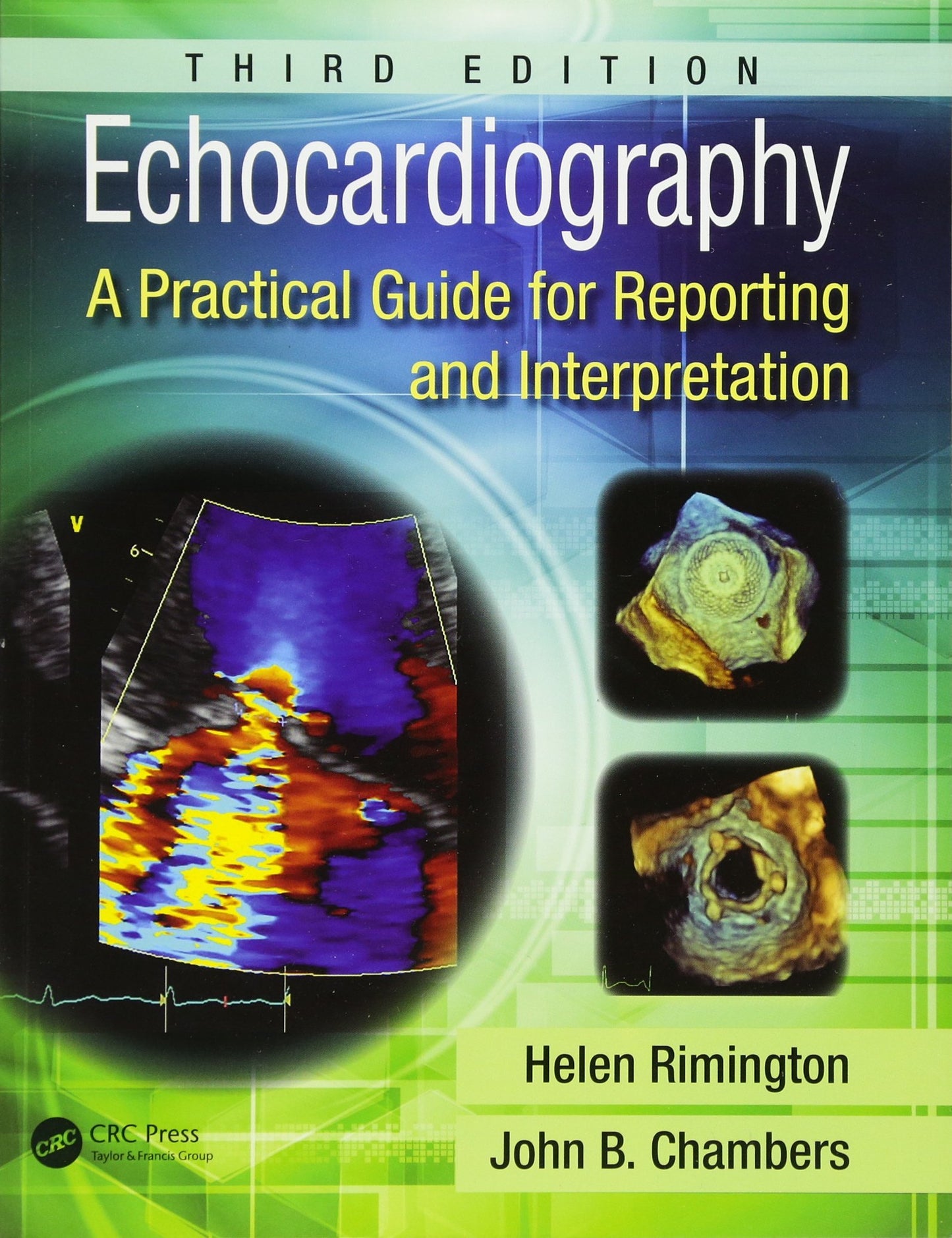 Echocardiography: A Practical Guide for Reporting and Interp