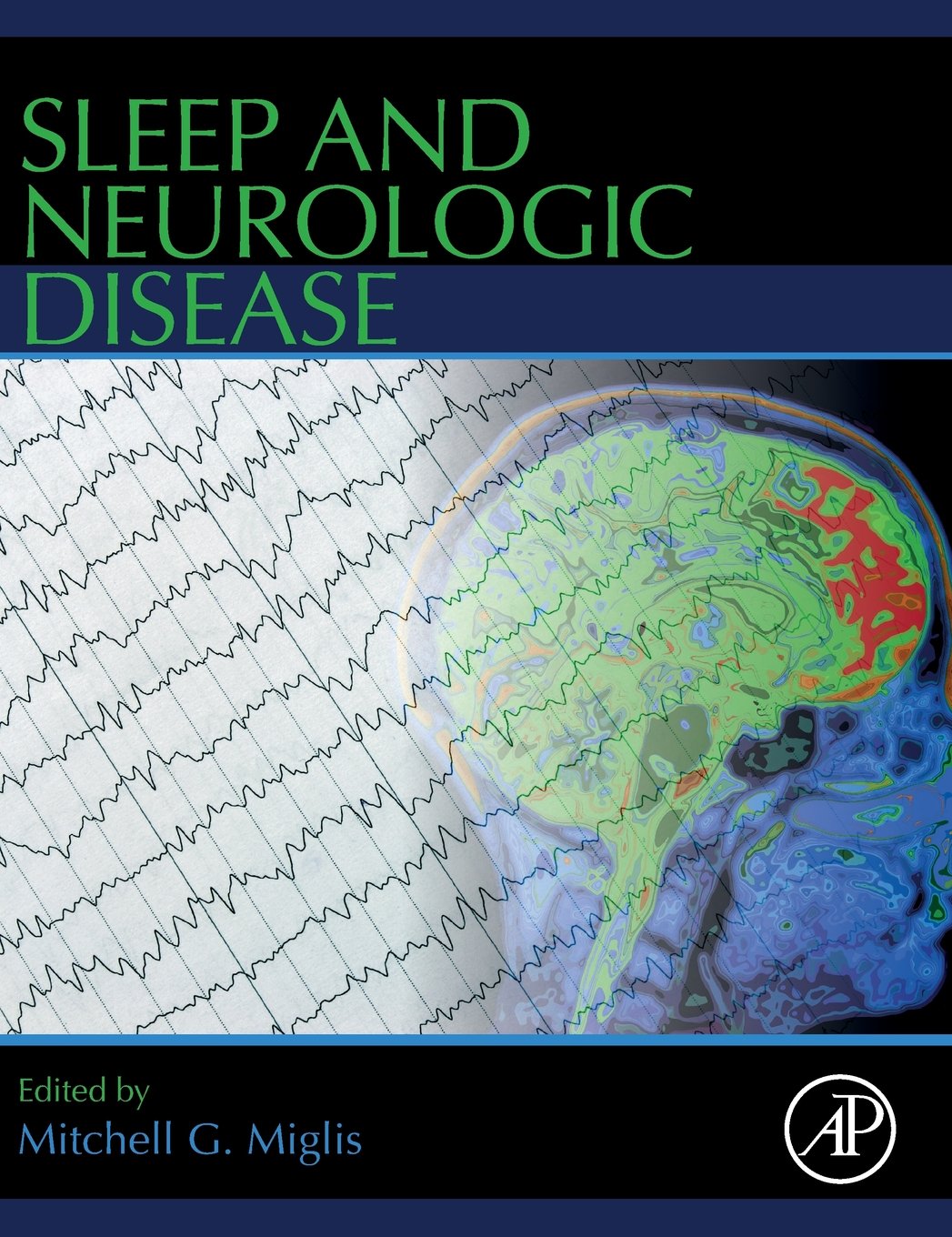 Sleep and Neurologic Disease