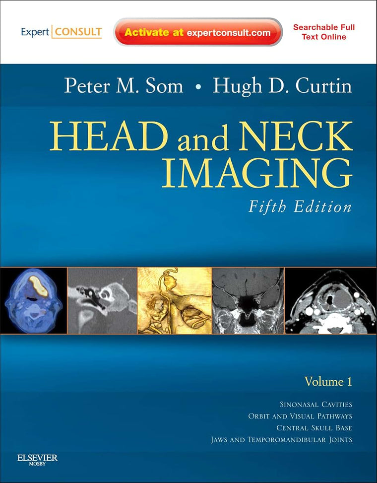 Head and Neck Imaging (Expert Consult)