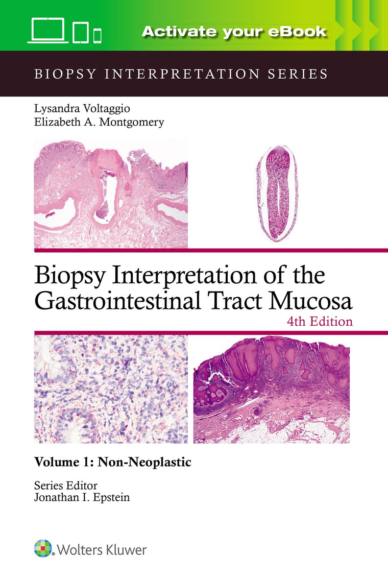 Biopsy Interpretation of the Gastrointestinal Tract Mucosa Volume 1: Non-Neoplastic: Print  eBook with Multimedia (Volume 1) (Biopsy Interpretation Series)