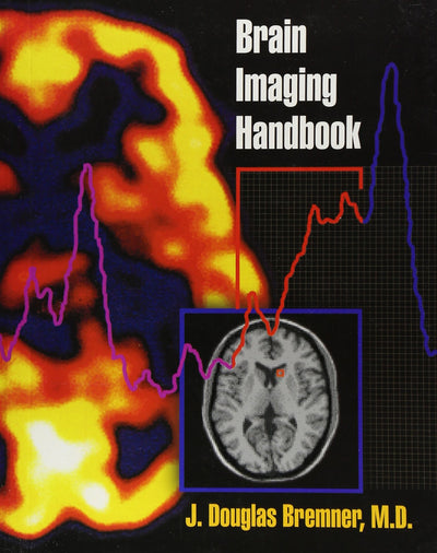 Brain Imaging Handbook by Bremner M.D., J. Douglas