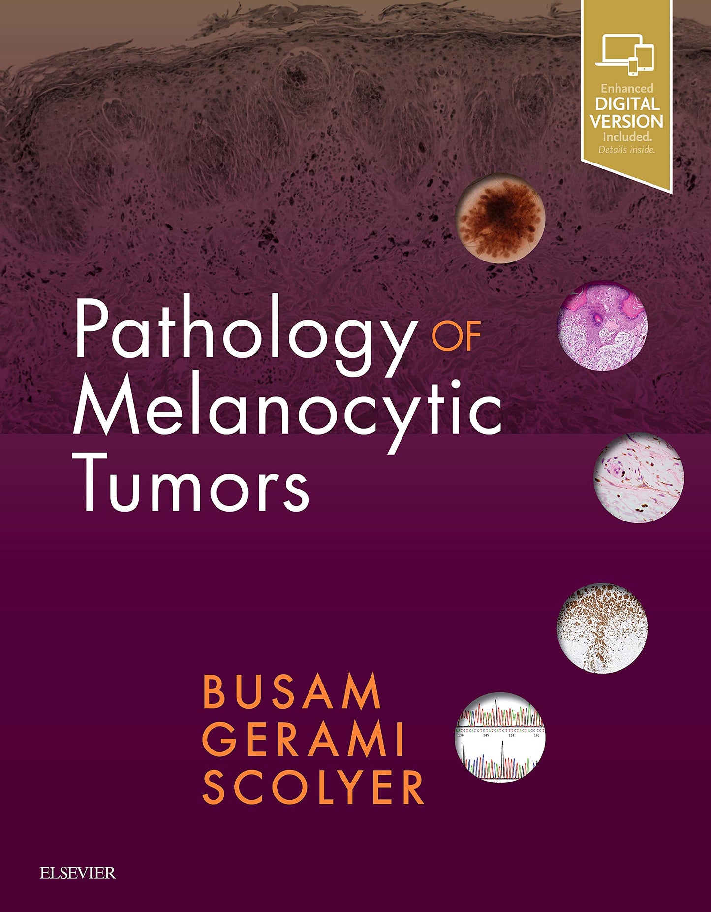 Pathology of Melanocytic Tumors by Busam MD, Klaus J.