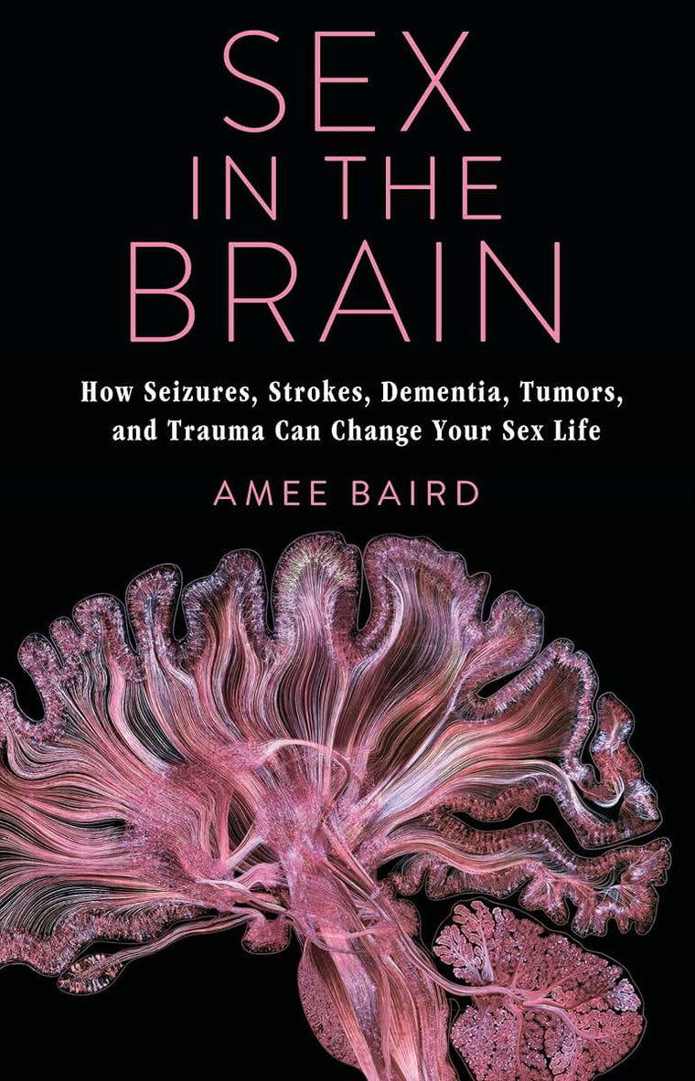 Sex in the Brain: How Seizures, Strokes, Dementia, Tumors, and Trauma Can Change Your Sex Life