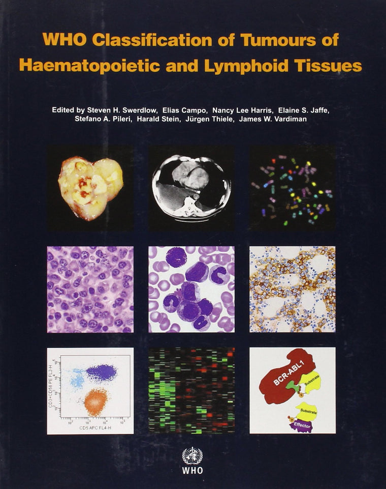 WHO Classification of Tumours of Haematopoietic and Lymphoid Tissue [OP] (Medicine)