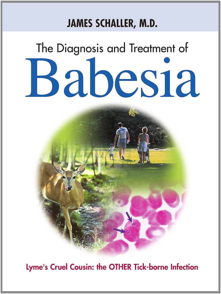 The Diagnosis and Treatment of Babesia