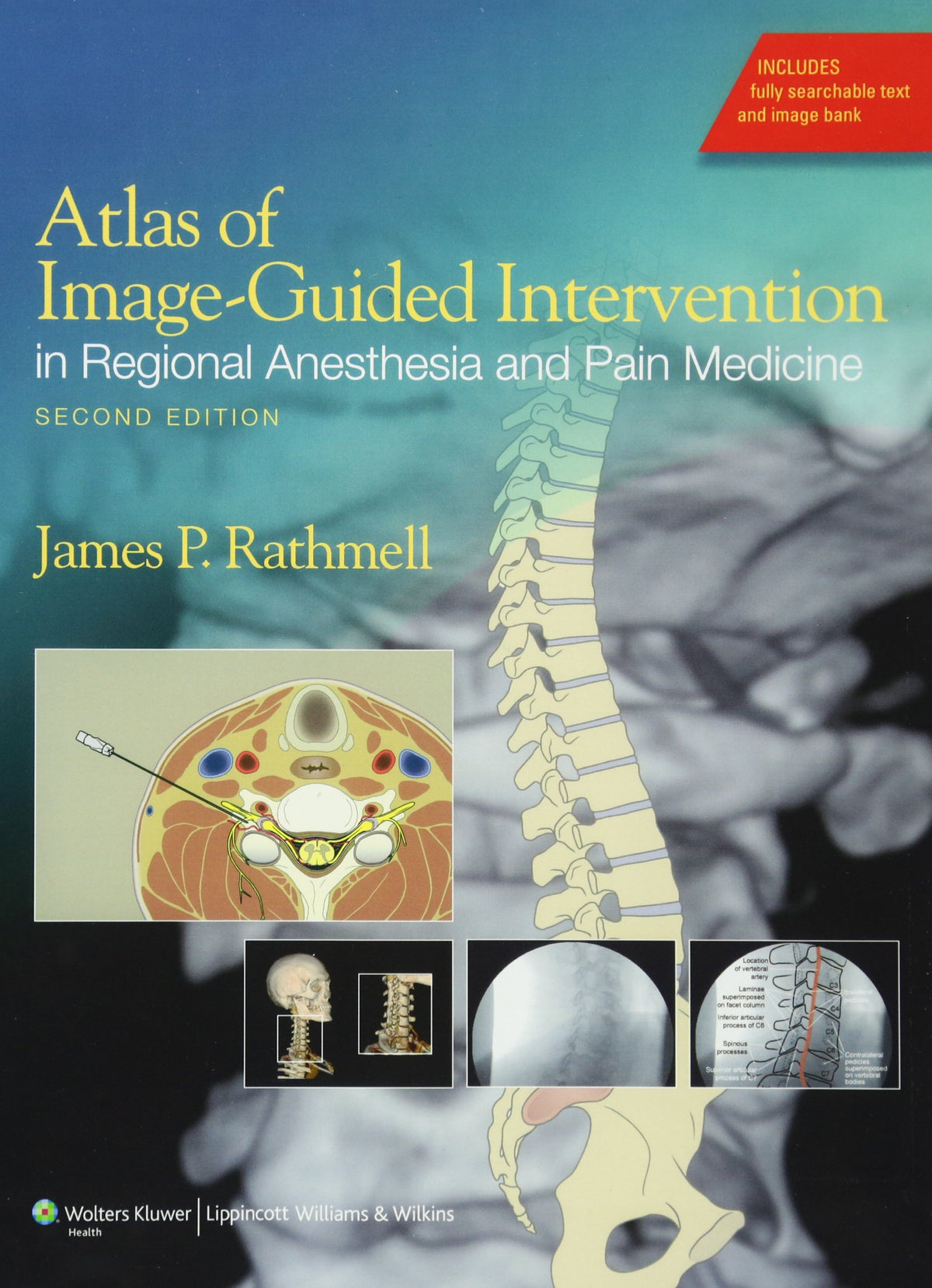 Atlas of Image-Guided Intervention in Regional Anesthesia and Pain Medicine