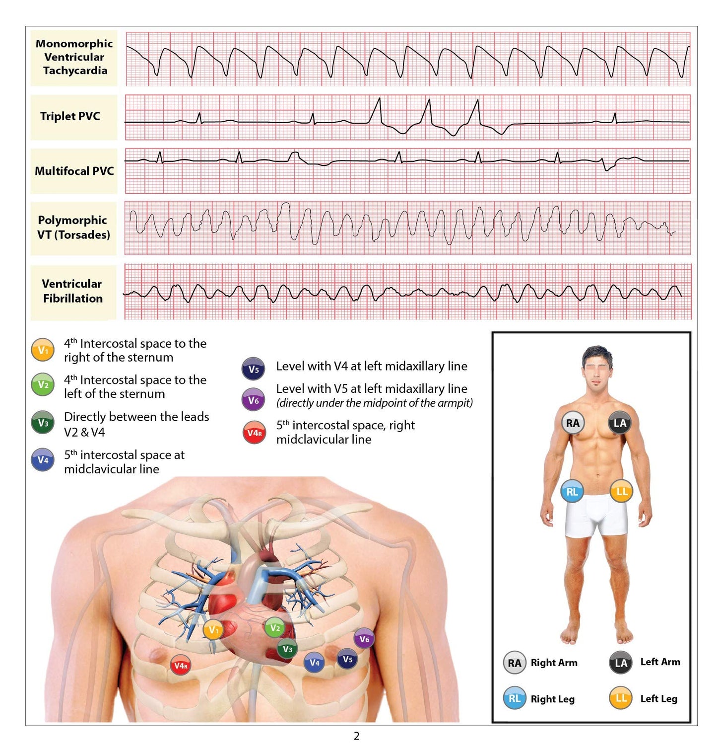 12 Lead EKG Pocket Card