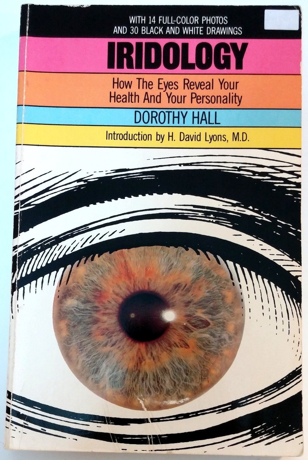 Iridology: How the Eyes Reveal Your Health and Personality