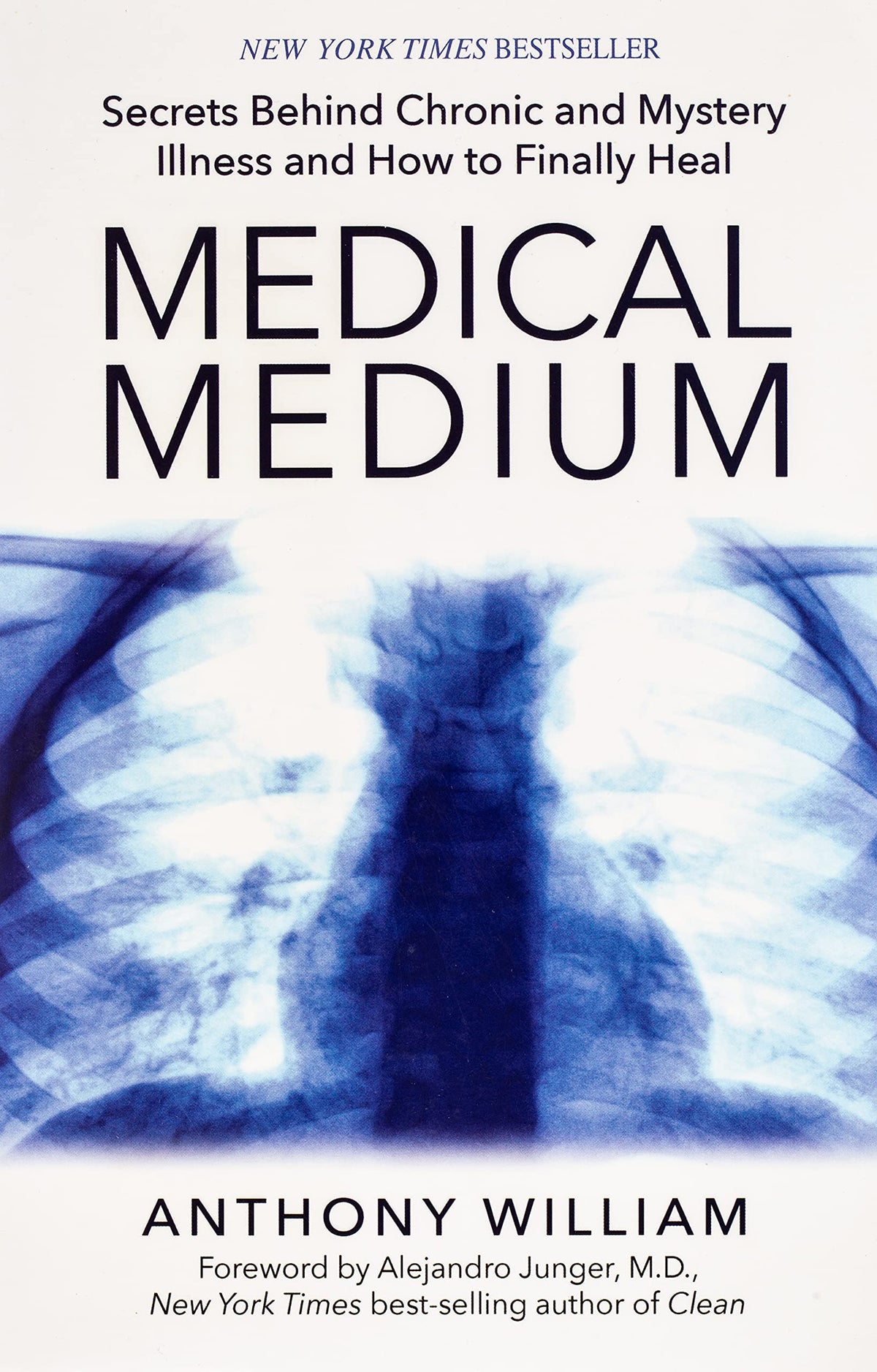 Medical Medium: Secrets Behind Chronic and Mystery Illness and How to Finally Heal [Paperback] [Jan 01, 1855] William, Anthony