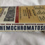 The Iron Disorders Institute Guide to Hemochromatosis: Sympt