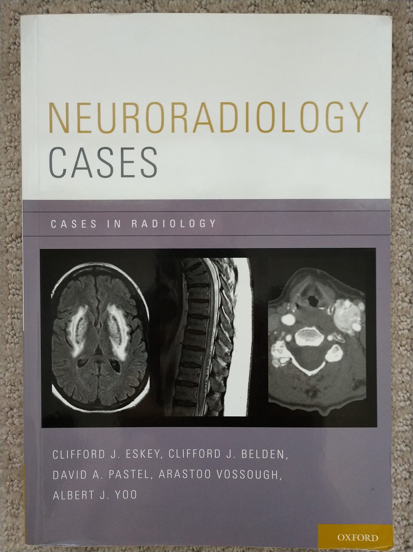 Neuroradiology Cases (Cases in Radiology)