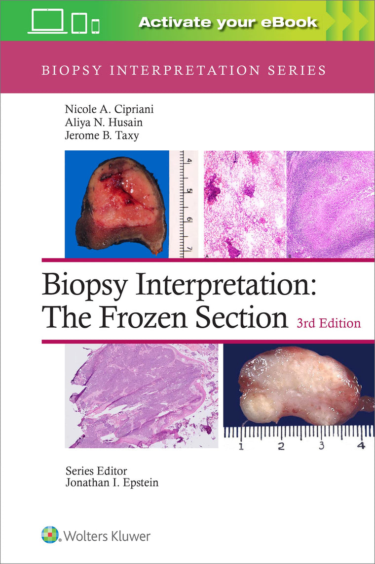 Biopsy Interpretation: The Frozen Section: Print  eBook with Multimedia (Biopsy Interpretation Series)