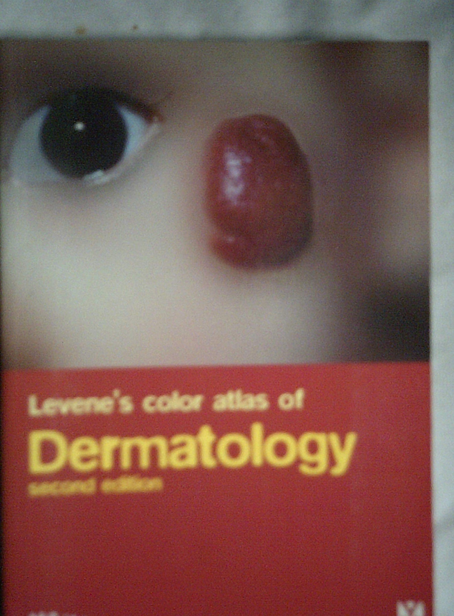 Levene's Color Atlas of Dermatology