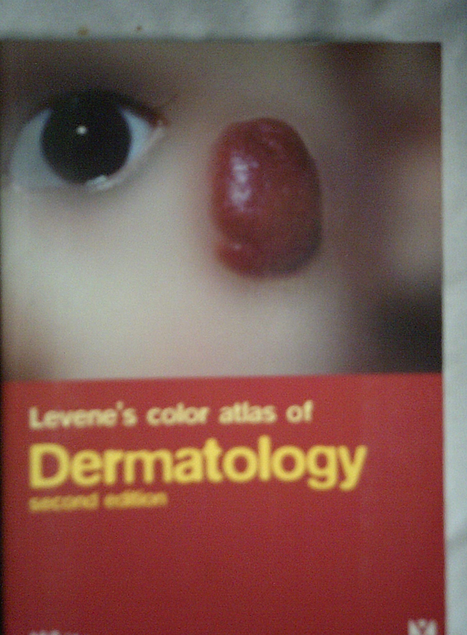 Levene's Color Atlas of Dermatology