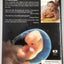 A Child is Born