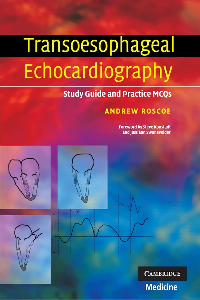 Transoesophageal Echocardiography: Study Guide and Practice MCQs