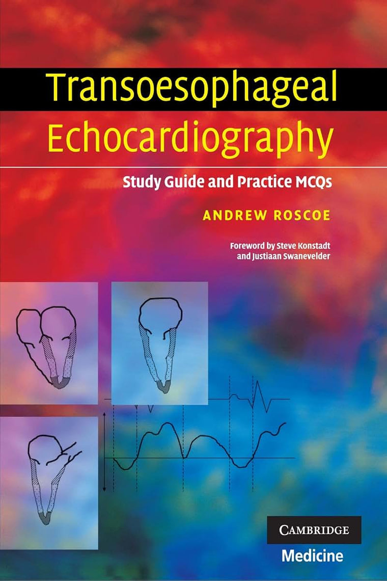 Transoesophageal Echocardiography: Study Guide and Practice MCQs