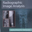 Radiographic Image Analysis by Martensen MA RT(R), Kathy McQ