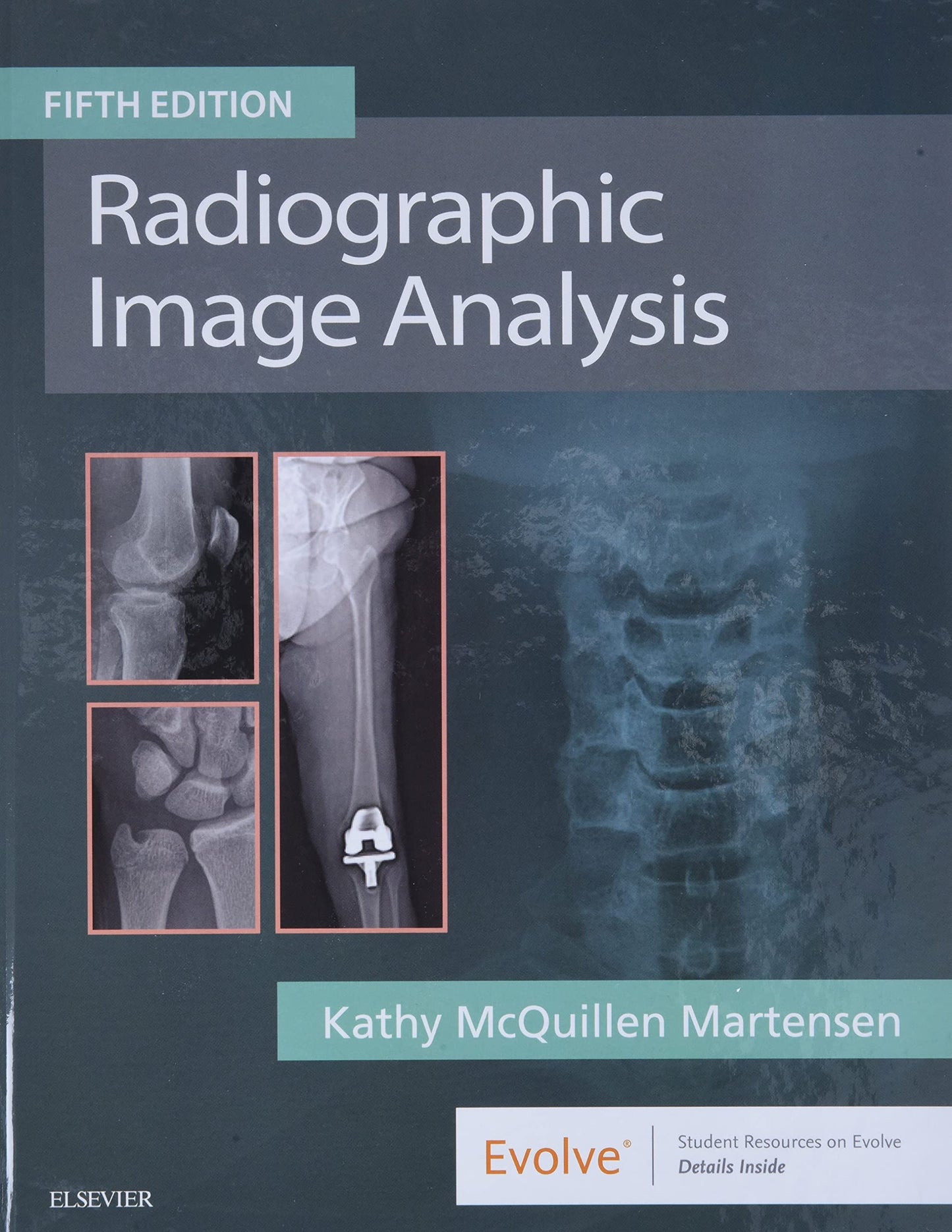 Radiographic Image Analysis by Martensen MA RT(R), Kathy McQ