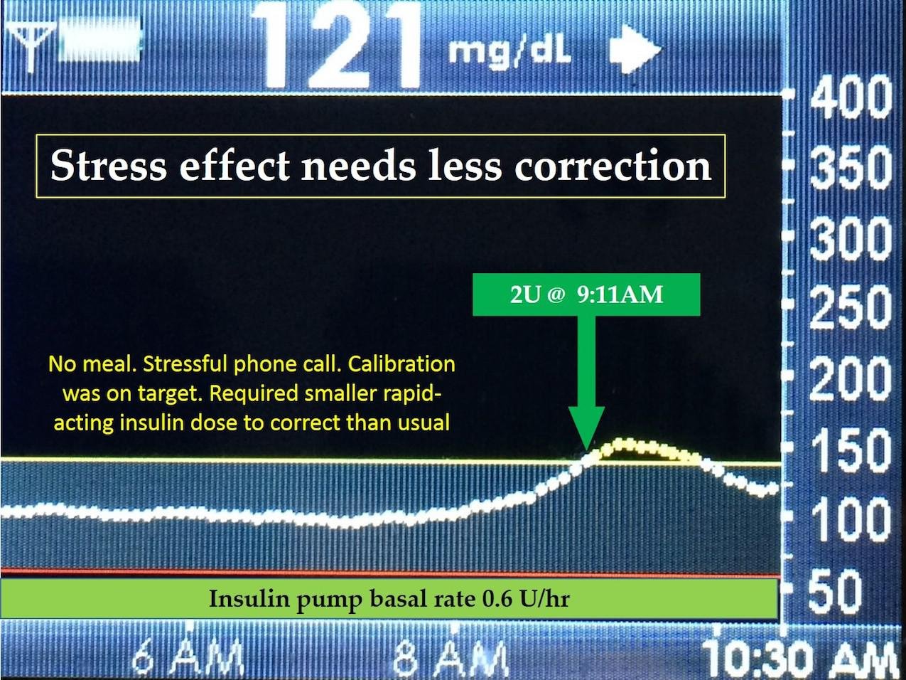 Sugar Surfing: How to Manage Type 1 Diabetes in a Modern World