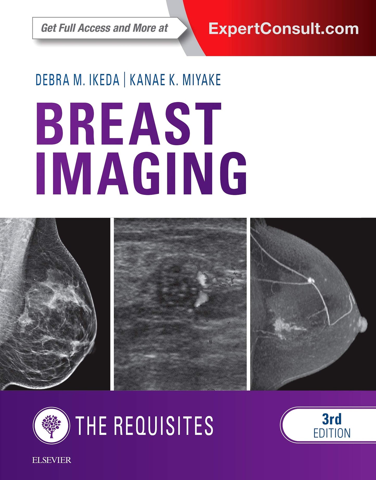 Breast Imaging: The Requisites (The Core Requisites) by Iked