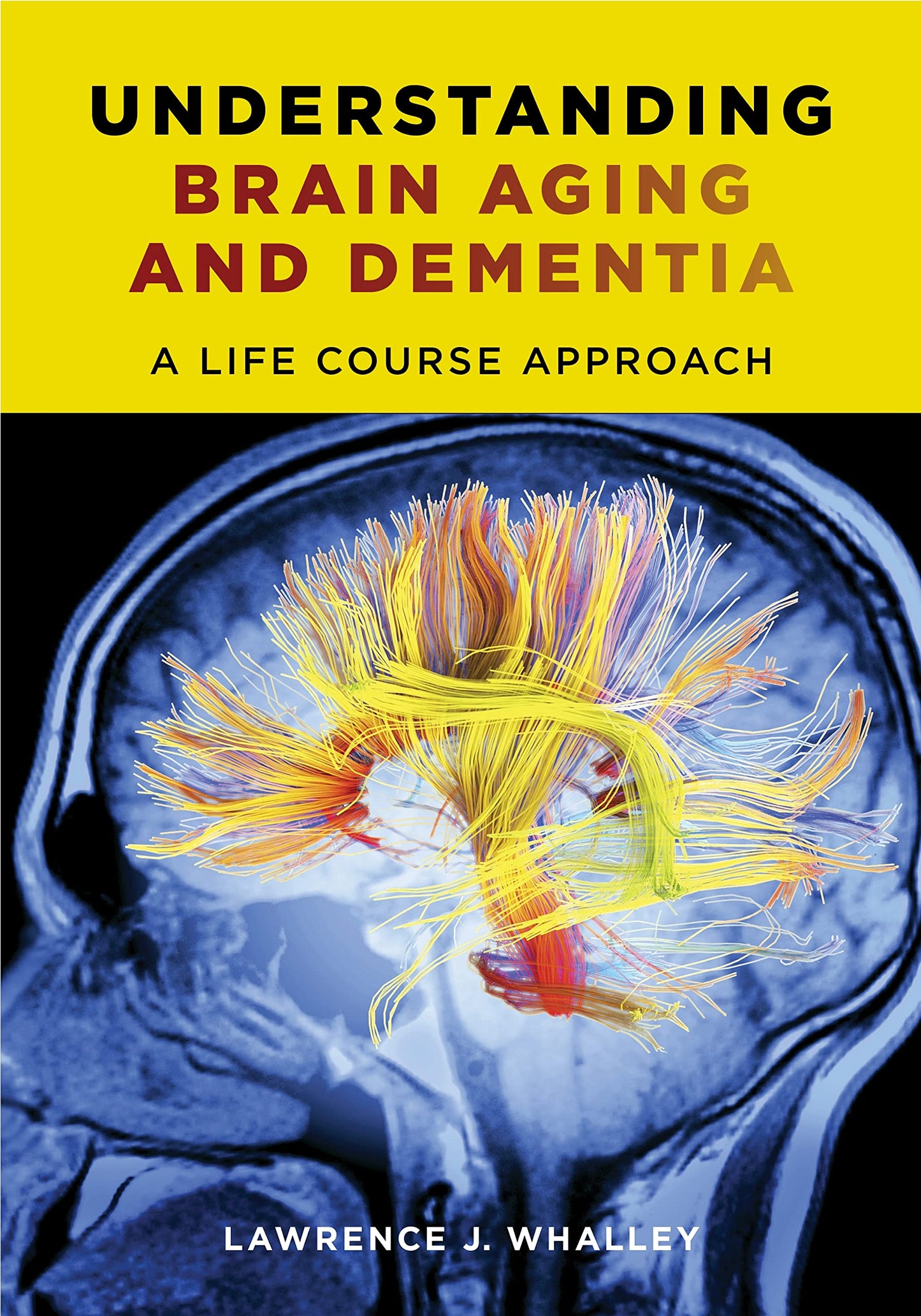 Understanding Brain Aging and Dementia: A Life Course Approa