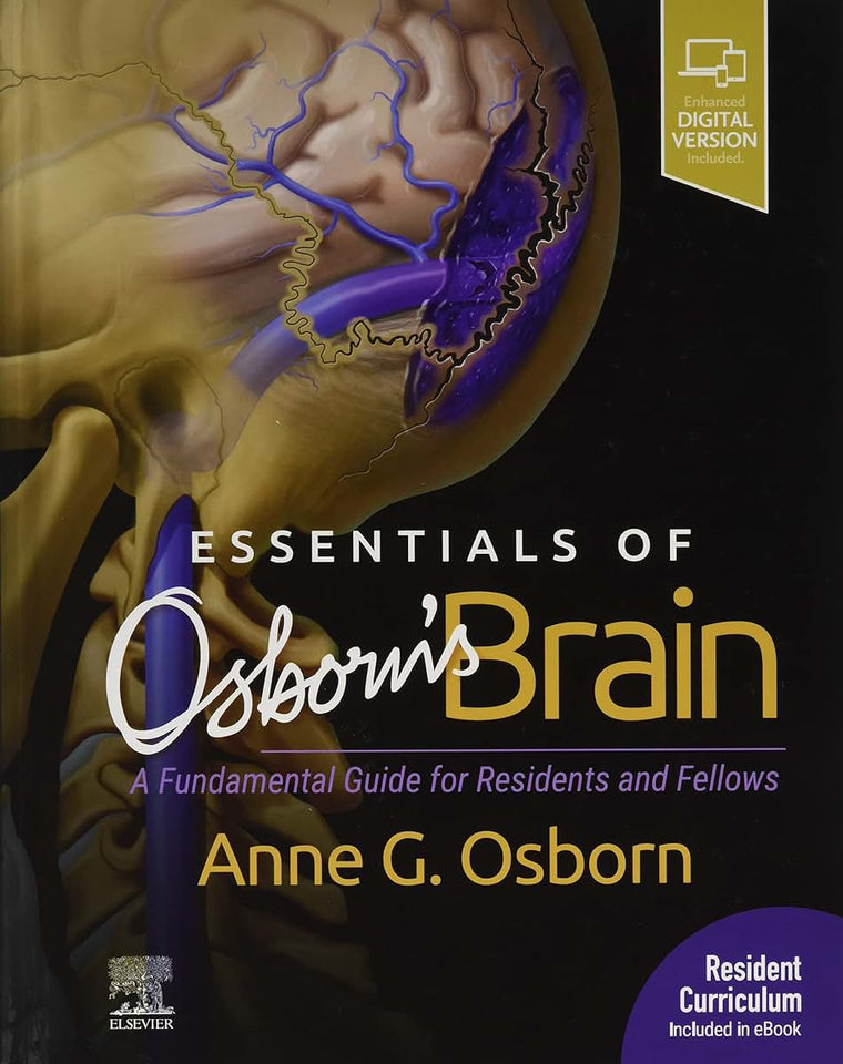 Essentials of Osborn's Brain: A Fundamental Guide for Residents and Fellows