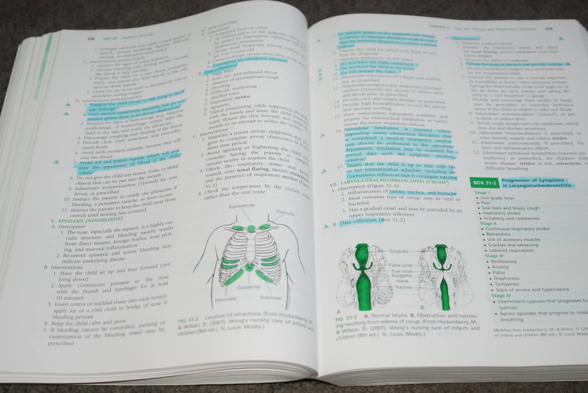 Saunders Comprehensive Review for the NCLEX-PN Examination (Saunders Comprehensive Review for Nclex-Pn)