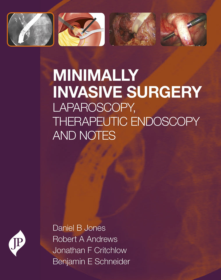 Minimally Invasive Surgery: Laparoscopy, Therapeutic Endoscopy and NOTES