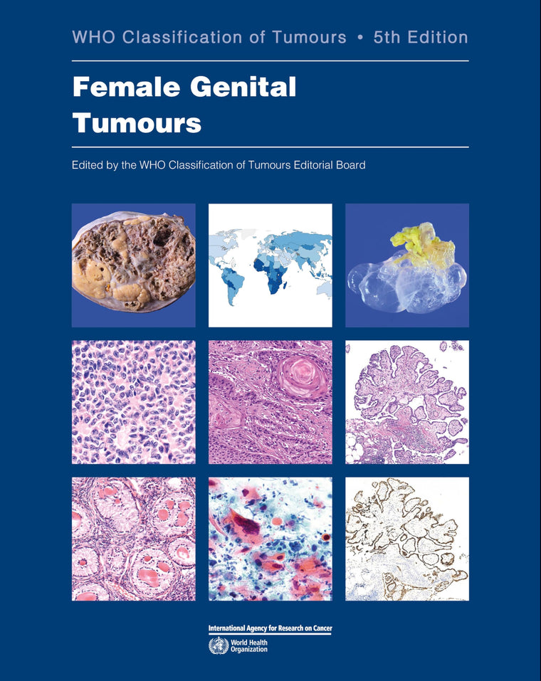 Female Genital Tumours: WHO Classification of Tumours (Medicine)