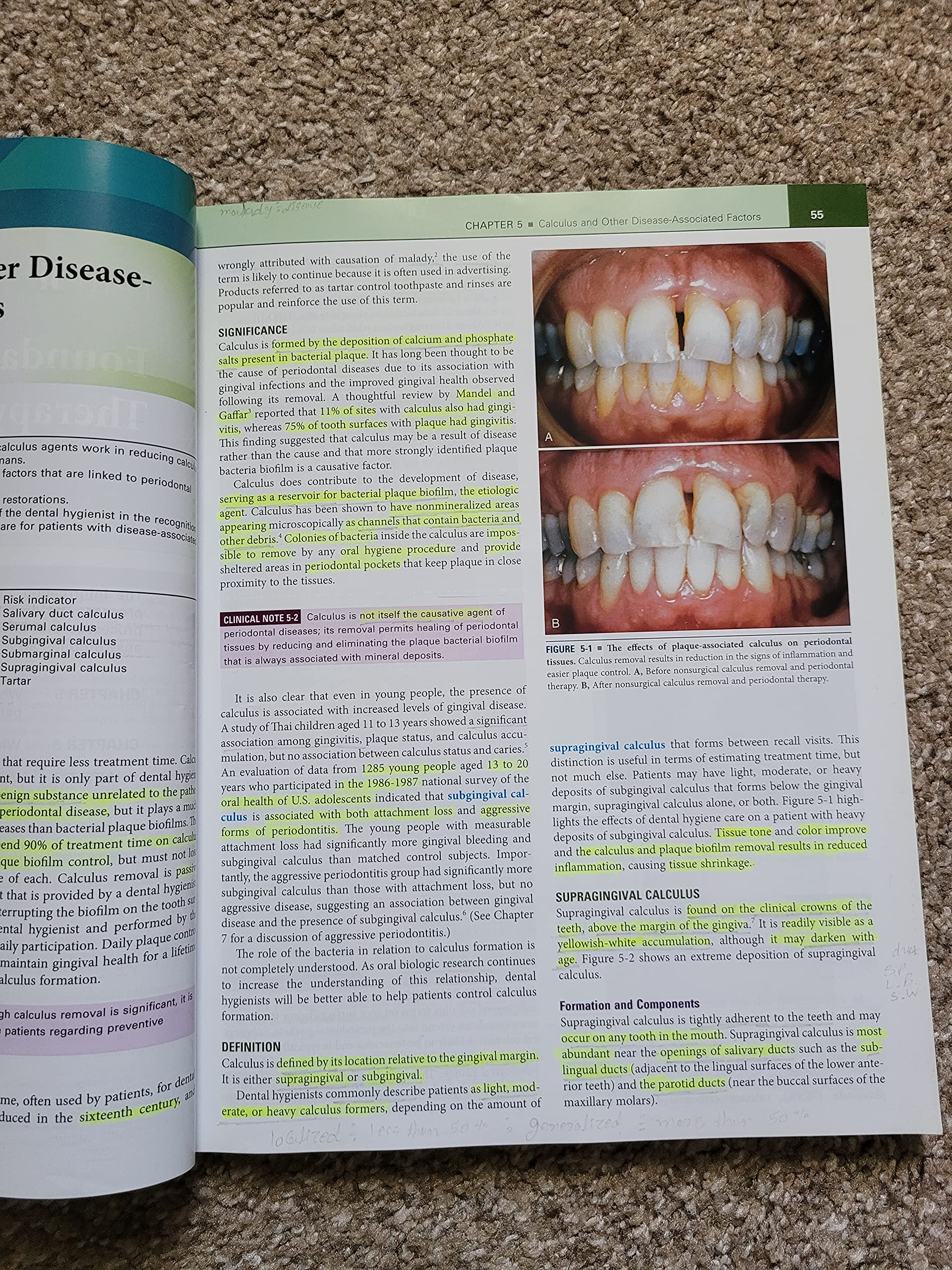 Periodontology for the Dental Hygienist (Perry, Periodontology for the Dental Hygienist)