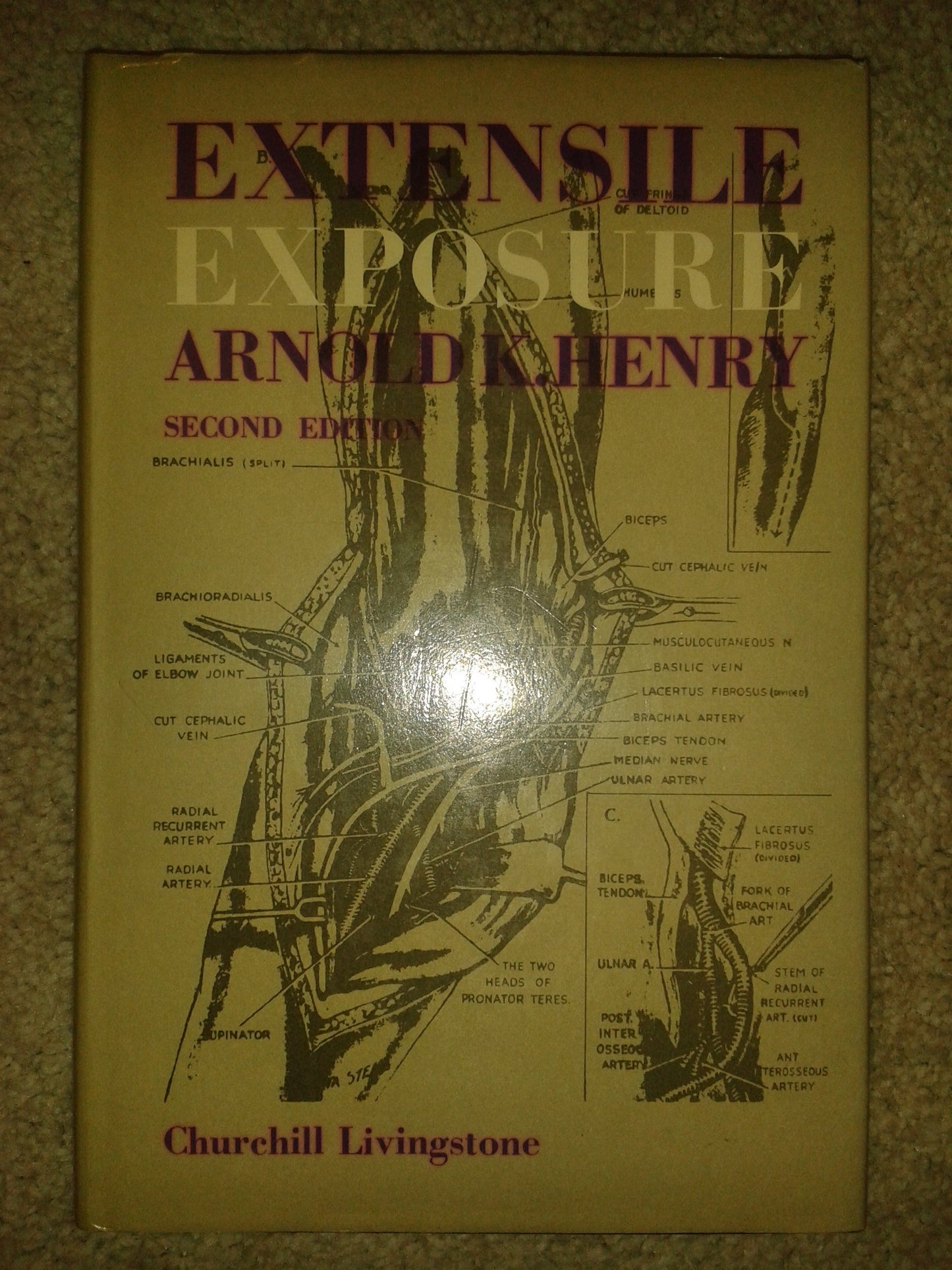 Extensile Exposure, 2nd Edition