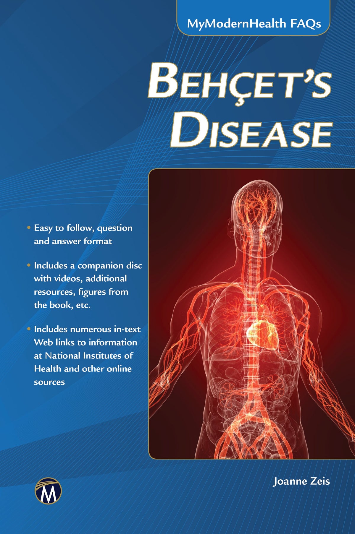 Behcets Disease (MyModernHealth FAQs)