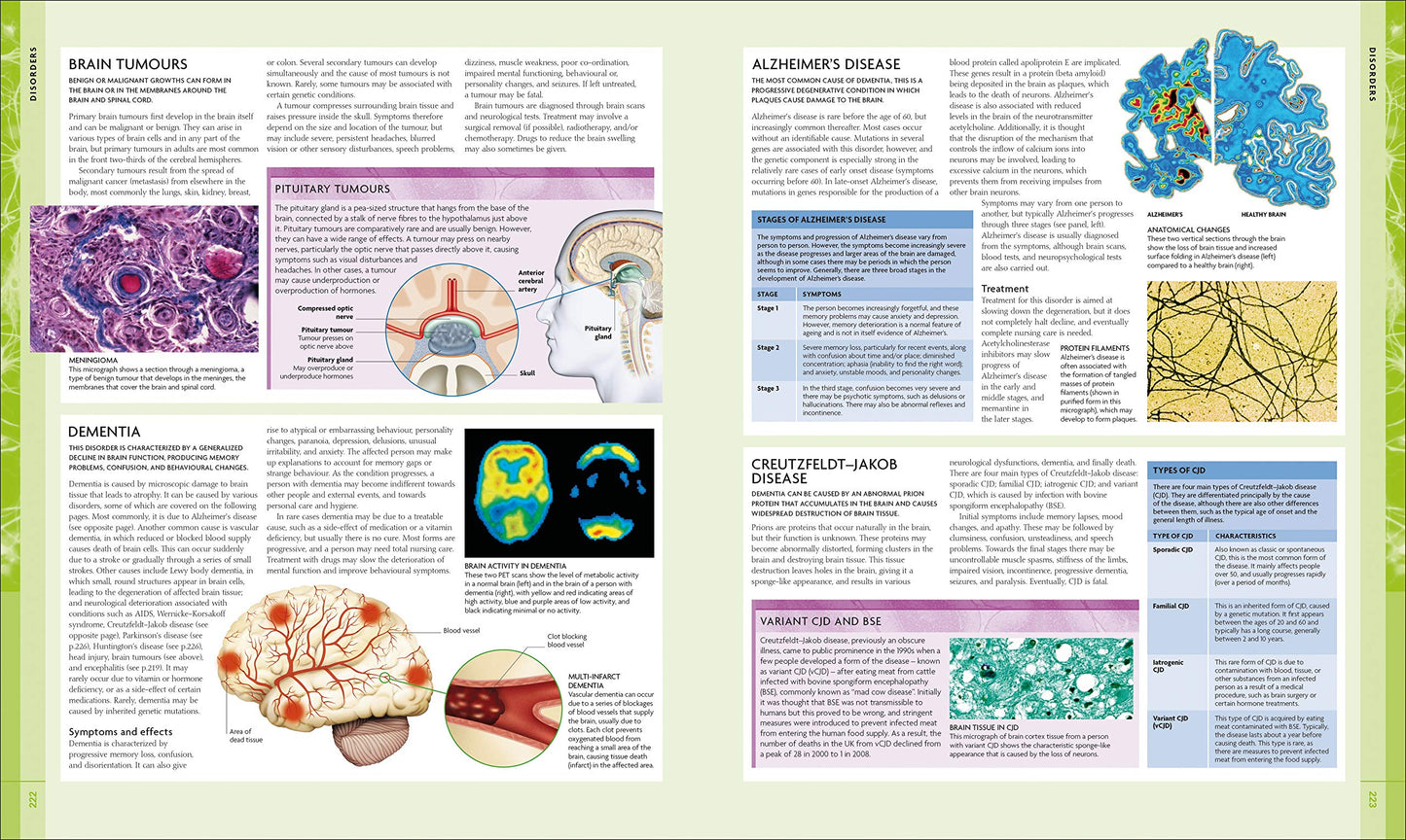 The Human Brain Book: An Illustrated Guide to its Structure, Function, and Disorders (DK Human Body Guides)
