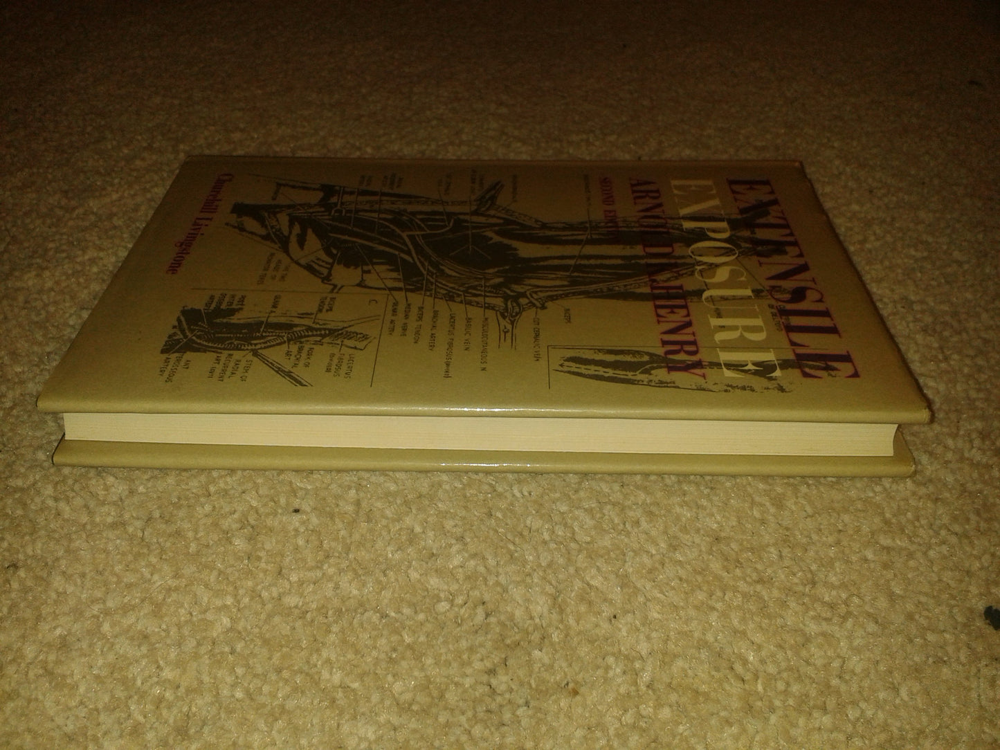 Extensile Exposure, 2nd Edition