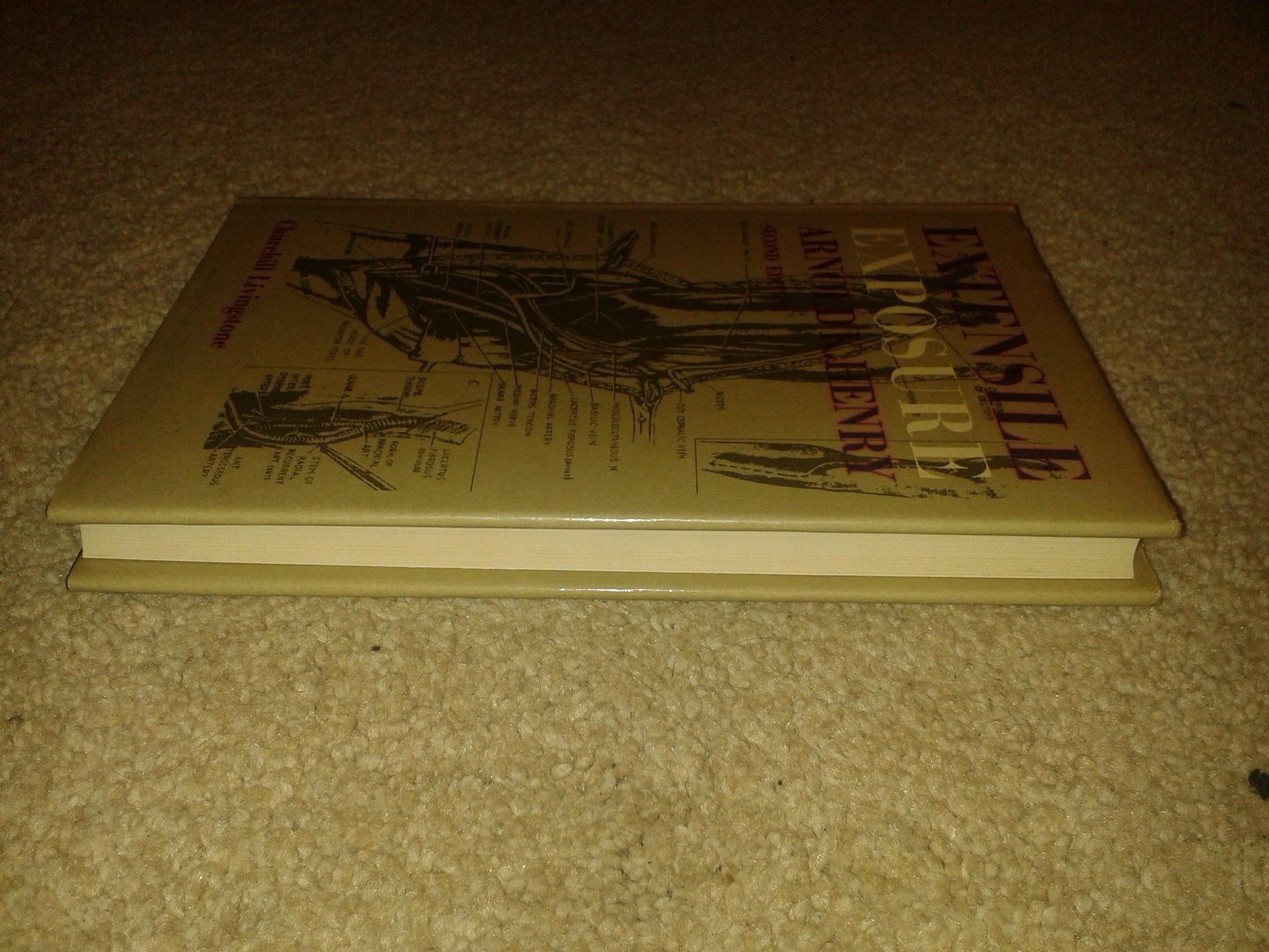 Extensile Exposure, 2nd Edition